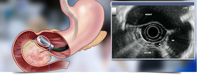 Best Gastroenterologist in Bathinda